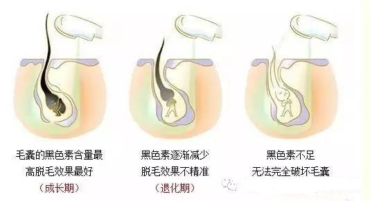 脱毛刮板，了解它的用途、种类和使用方法